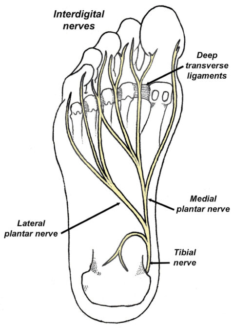 The Peel and Stick Interdigital Neuroma Balance - Human Locomotion