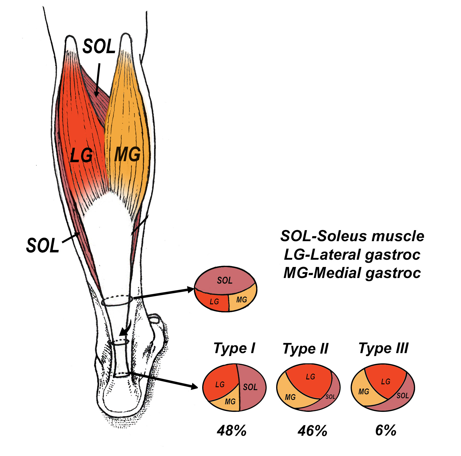 The Ideal Exercises For Managing Insertional Achilles Injuries - Human ...