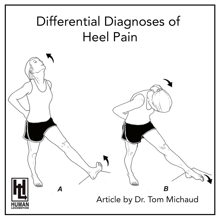 Heel Pain & Heel Pain Treatment | Foundation Podiatry